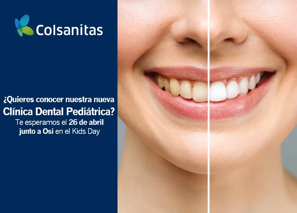 clinicas-dentales-colsanitas-blanqueamientodental