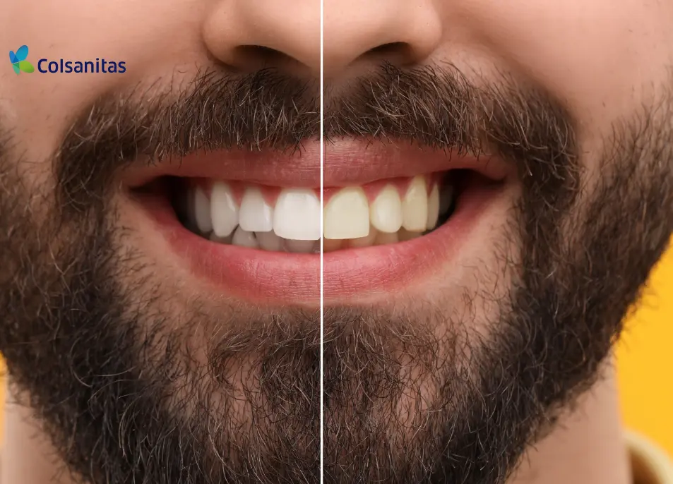 clincas-dentales-blanque-dental-casa-tarifa-pref-442000